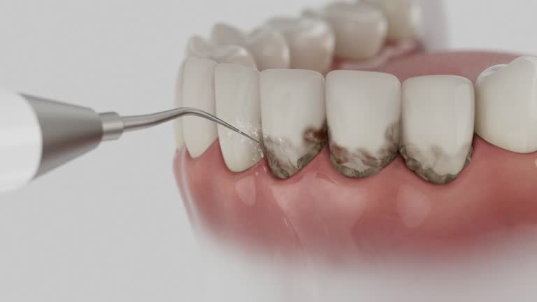 Trusted Root Canal Treatment service in Mount Gilead, NC - Dentist Open Now